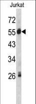 SERPING1 / C1 Inhibitor Antibody (aa285-314)