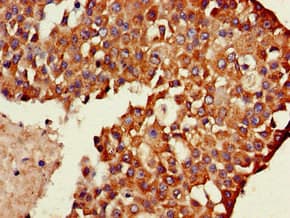 Polyclonal Rabbit anti-Human TXK / RLK Antibody (IHC, IF, WB)