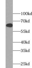 FOS / c-FOS Antibody