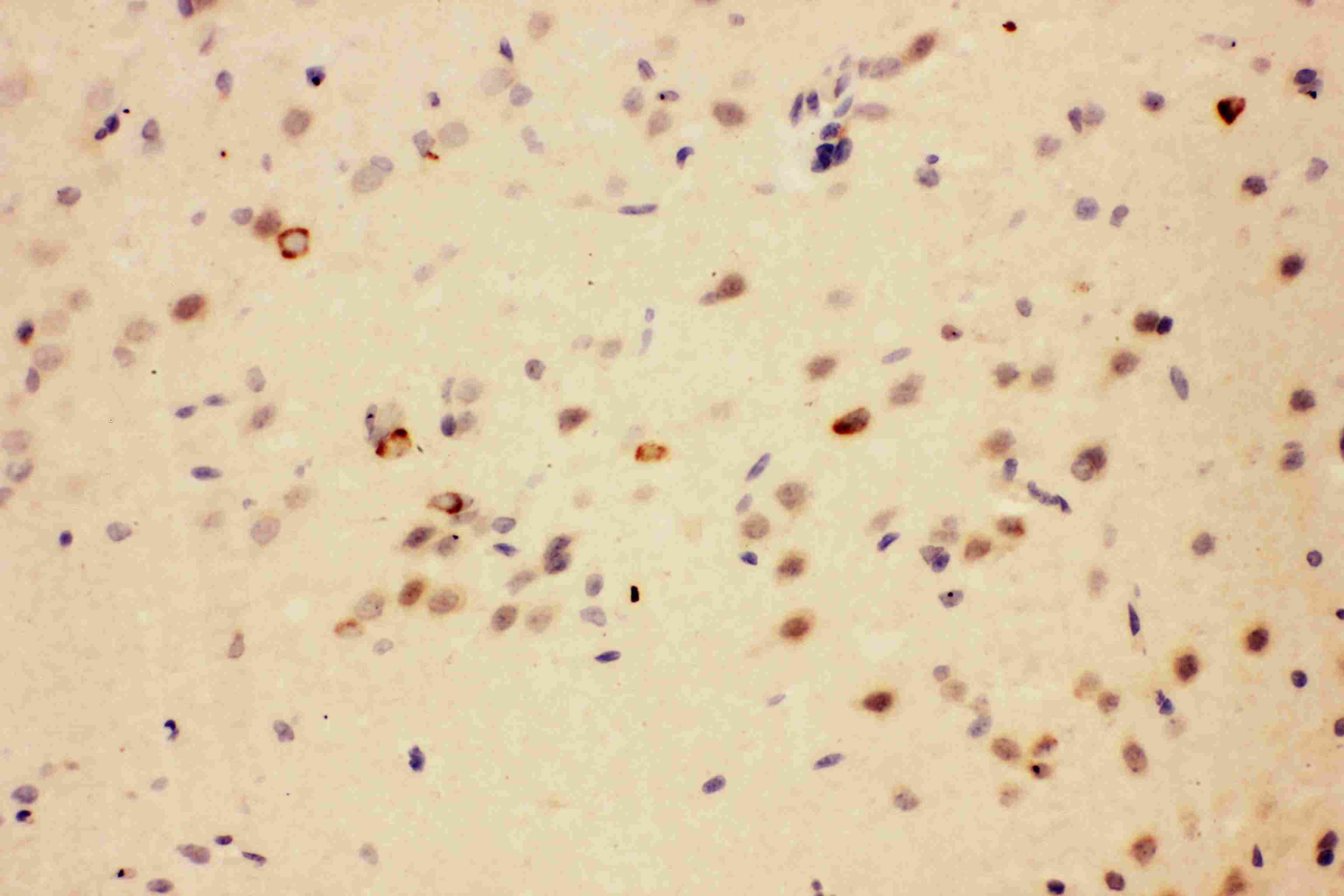 Polyclonal Rabbit anti-Human CACYBP Antibody (aa160-175, IHC, WB)
