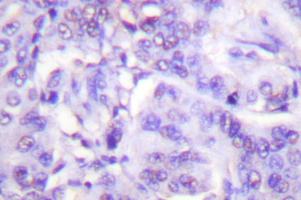 MDM2 Antibody (phospho-Ser166)