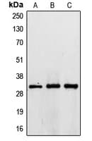 TIMP3 Antibody (Internal)