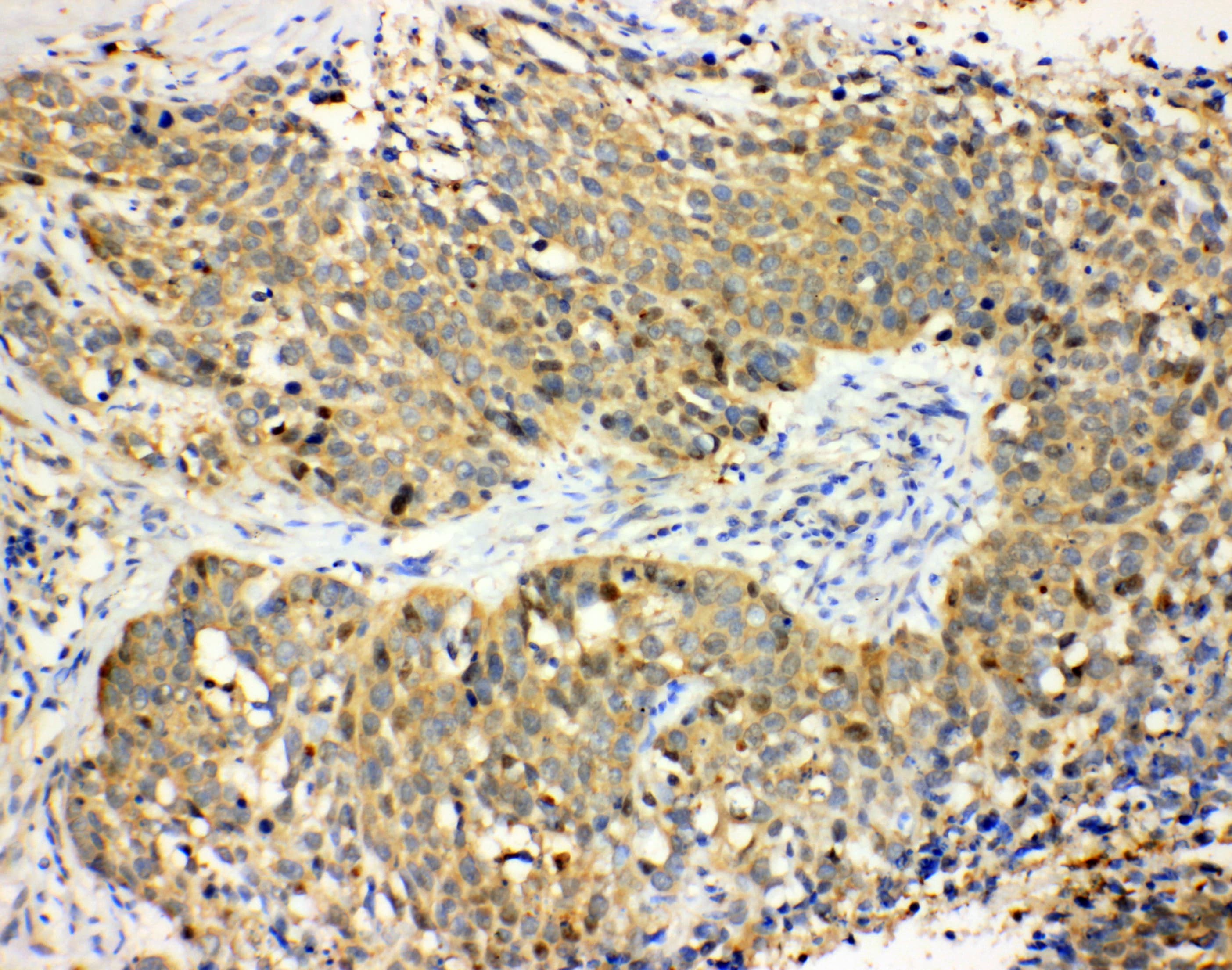 Polyclonal Rabbit anti-Human HP / Haptoglobin Antibody (aa294-309, IHC, WB)