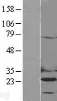 DHFR Protein (Over-Expression Lysate Myc-DDK (Flag))