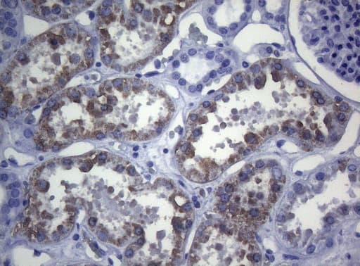 CTSL / Cathepsin L Antibody (clone OTI8H2)