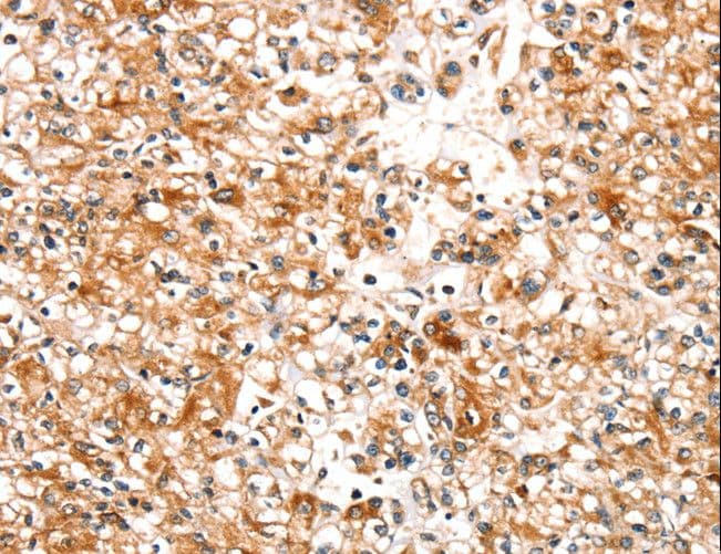SLC25A12 / ARALAR Antibody