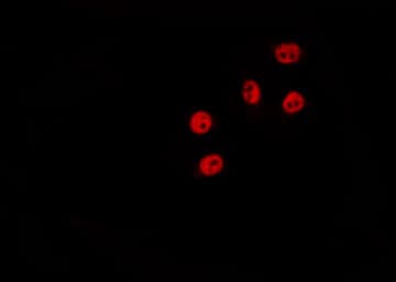 ZAK / MLTK Antibody