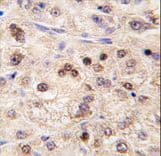 Polyclonal Rabbit anti-Human ZBTB7B / HcKrox Antibody (aa181-210, IHC, WB)