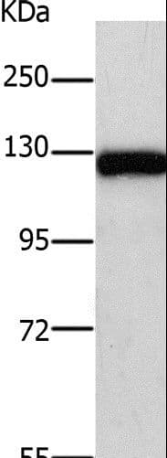 PARP1 Antibody