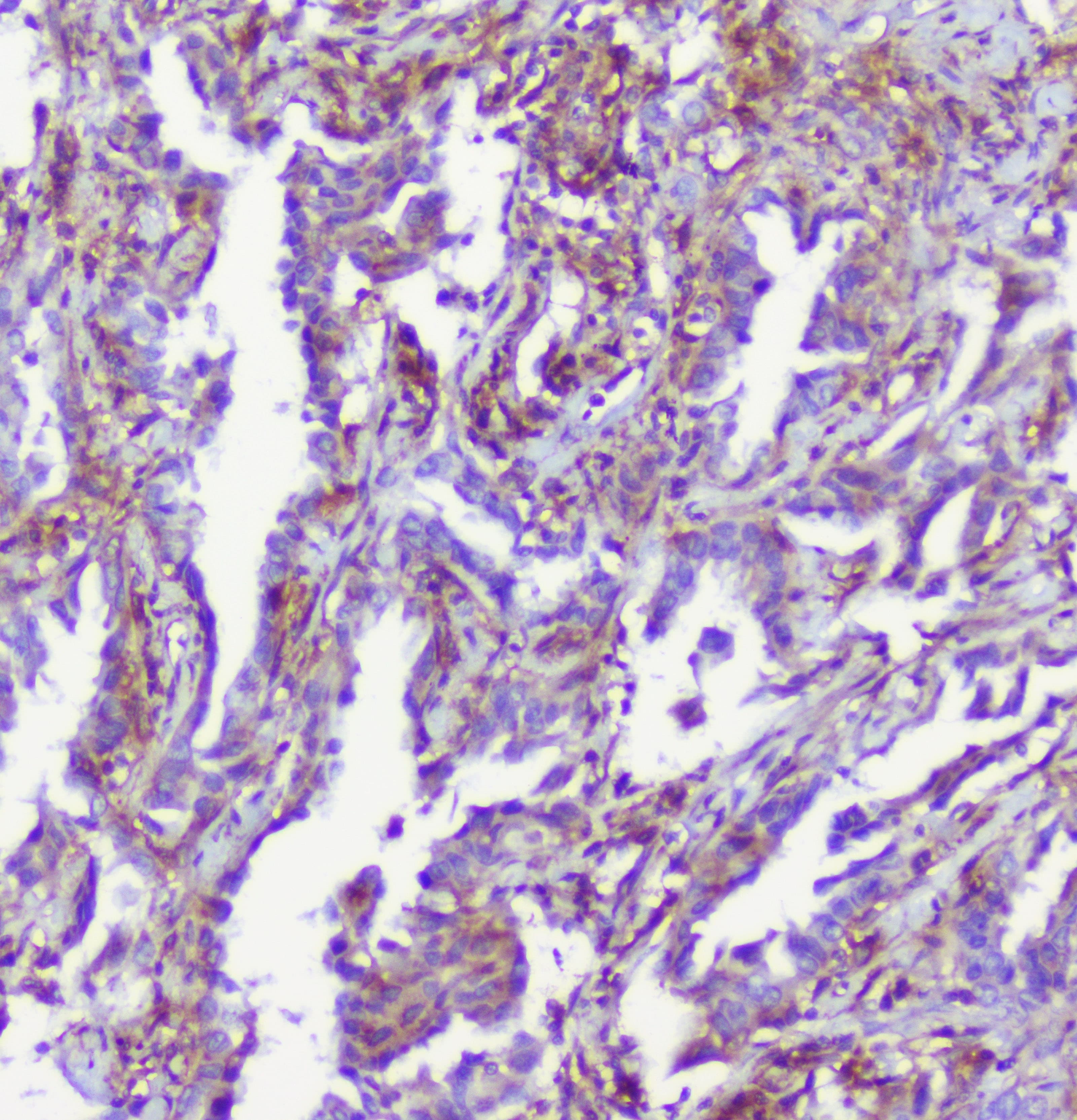 Polyclonal Rabbit anti-Human RP2 Antibody (IHC, WB)