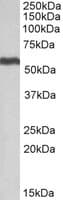 IHC-plus™ Polyclonal Goat anti-Human ALDH5A1 Antibody (aa485-496, IHC, WB)
