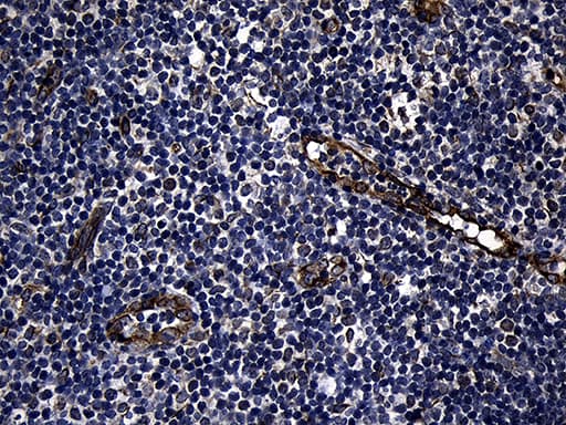 FBXO25 Antibody (aa1-191, clone OTI6F11)