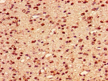 Polyclonal Rabbit anti-Human HIST1H2AI Antibody (IHC, IF)