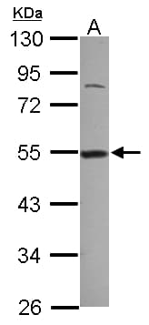 IHC-plus™ DDX39 Antibody