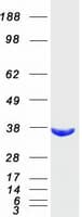 Human AKR1B10 Protein (Recombinant Myc-DDK (Flag))