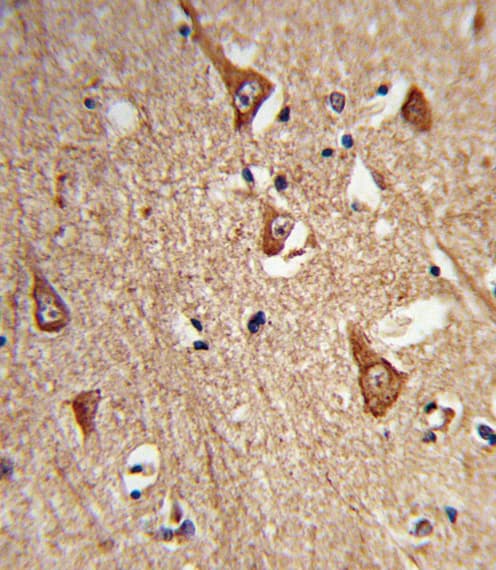 CPLX1 / Complexin 1 Antibody (aa33-60)