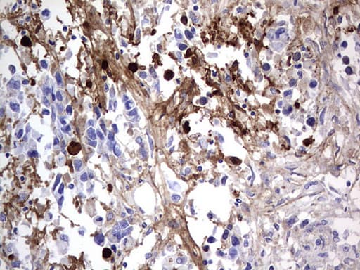 Monoclonal Mouse anti-Human FN1 / Fibronectin Antibody (clone OTI1G2, aa32-307, IHC, WB)