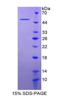 Mouse ITGA5/Integrin Alpha 5/CD49e Protein (Recombinant His-GST)