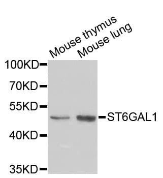 Polyclonal Rabbit anti-Human ST6GAL1 / CD75 Antibody (IHC, WB)