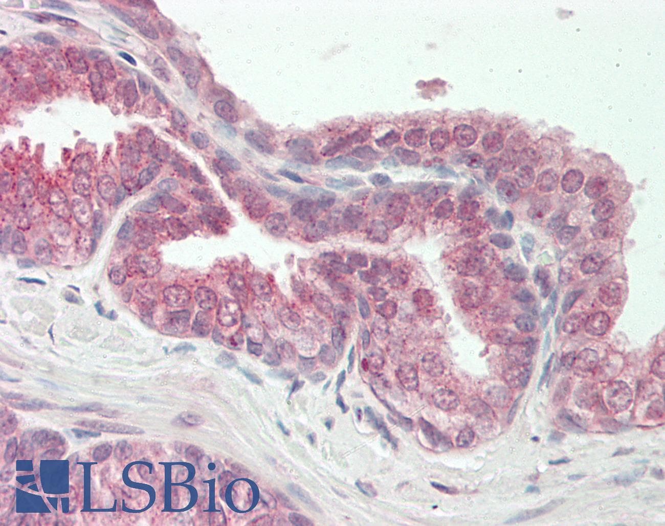 Polyclonal Rabbit anti-Human BAF60B / SMARCD2 Antibody (aa440-489, IHC, WB)