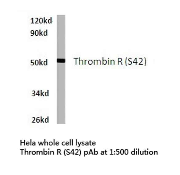 Polyclonal Rabbit anti-Human F2R / Thrombin Receptor / PAR1 Antibody (Ser42, WB)