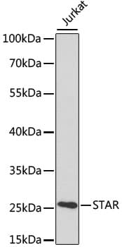 Polyclonal Rabbit anti-Human STAR Antibody (IF, WB)