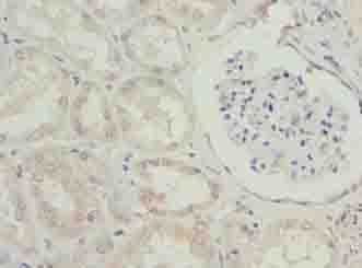 EFCAB12 / C3orf25 Antibody