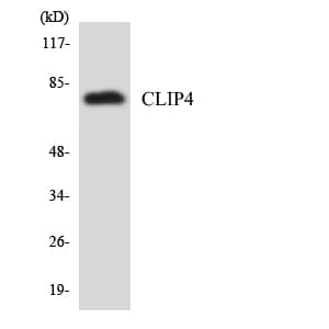 CLIP4 / RSNL2 Antibody (aa312-361)