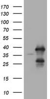 Monoclonal Mouse anti-Human UBE2J1 Antibody (clone OTI3C11, IHC, WB)