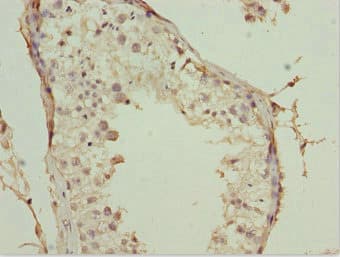 POC1A / SOFT Antibody