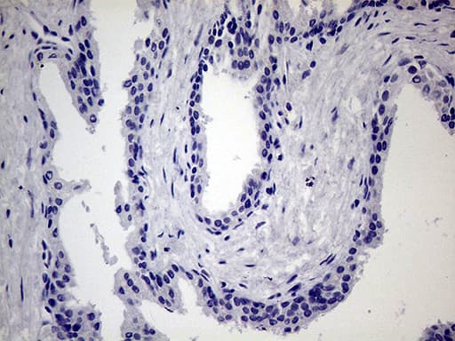 MAPK8IP1 / JIP1 Antibody (clone OTI1D9)