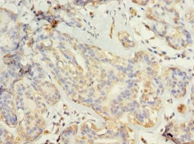 Polyclonal Rabbit anti-Human TUBG2 / Tubulin Gamma 2 Antibody (IHC)