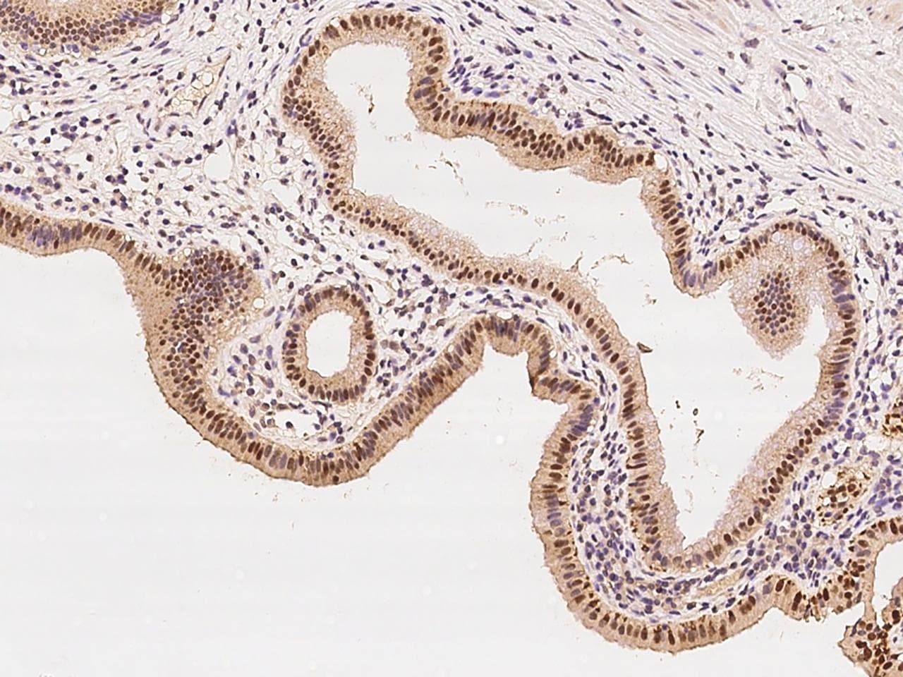 Polyclonal Rabbit anti-Human ZNF766 Antibody (IHC, WB)