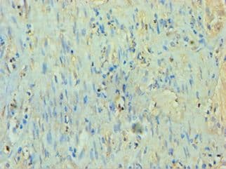 TP53I3 / PIG3 Antibody (aa163-332)
