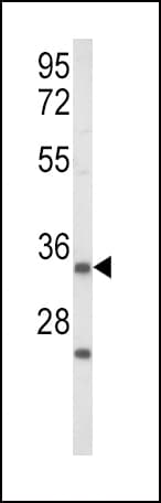 IHC-plus™ IGFBP2 / IGF-BP53 Antibody (aa277-305)