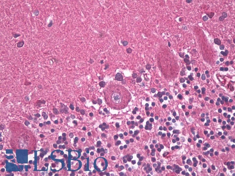 IHC-plus™ GABRB3 Antibody (clone S87-25)