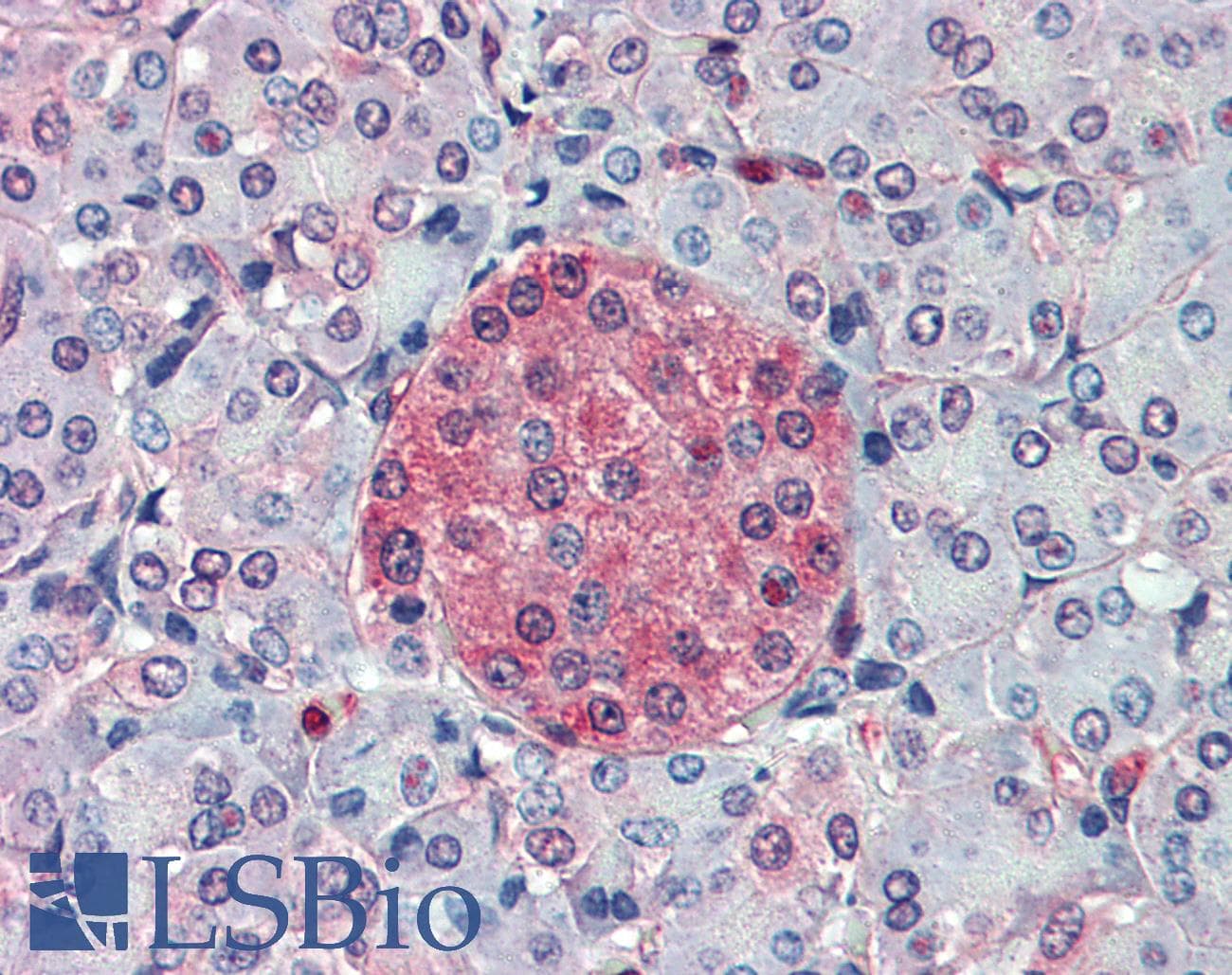 IHC-plus™ SLC11A2 / DMT1 Antibody (C-Terminus)