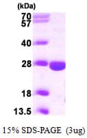 Human PPCDC Protein (Recombinant His)
