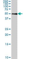 SMAD1 Antibody (clone 2E9)