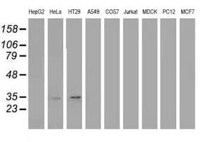 ANXA3 / Annexin A3 Antibody (clone OTI2F3)