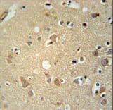 Polyclonal Rabbit anti-Human P2RX7 / P2X7 Antibody (aa563-592, IHC, WB)