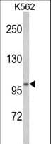 ATP12A Antibody (aa833-859)