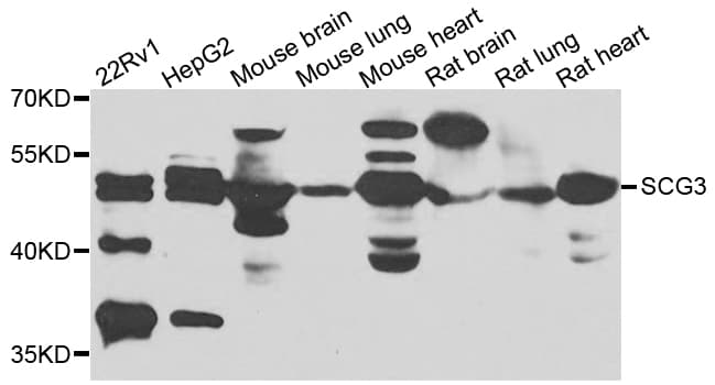 IHC-plus™ SCG3 / Secretogranin 3 Antibody