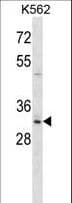 HOXB8 Antibody (aa214-243)