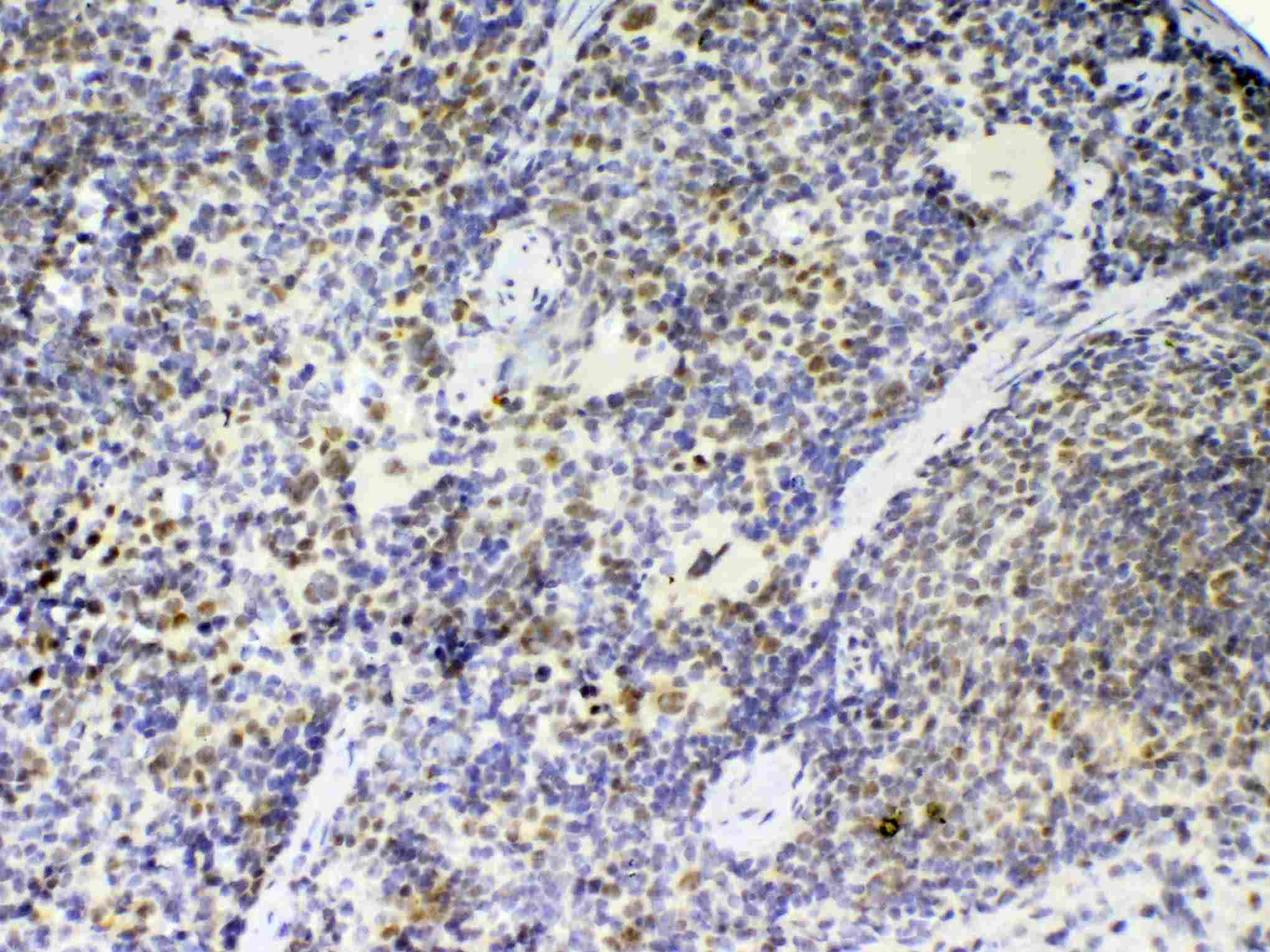 Polyclonal Rabbit anti-Mouse PTPN22 / PEP Antibody (IHC, WB)