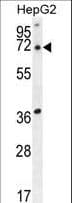 ACOT11 / THEA Antibody (aa549-575)