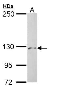 PHKA2 Antibody (aa1172-1235)