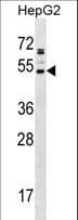 AADACL2 Antibody (aa156-182)