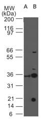Monoclonal Mouse anti-Human IL3RA / CD123 Antibody (clone 18N6B12, aa275-293, WB)