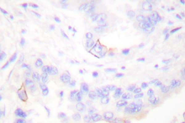 CRK Antibody (aa200-250)